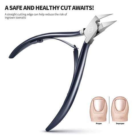 ingrown toenail clipper|best ingrown toenail clippers.